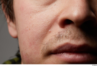 HD Skin Brandon Davis cheek face head lips mouth mustache…